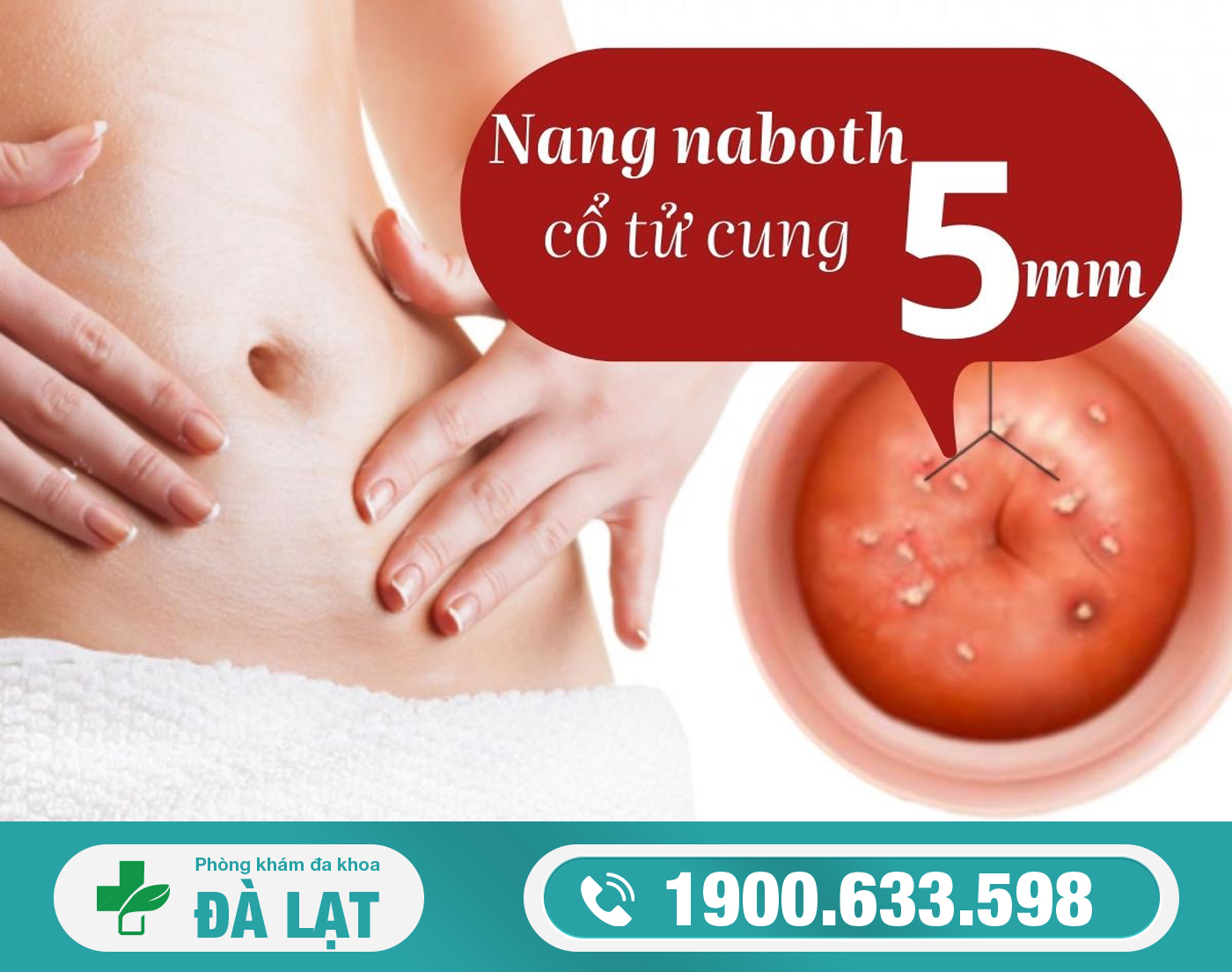 NANG NABOTH CỔ TỬ CUNG KÍCH THƯỚC 4MM - 11MM